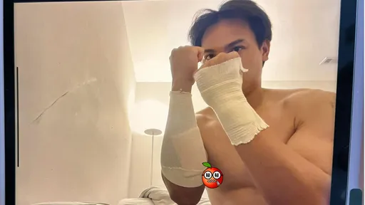 「觸身球I AM OK！」張育成被「紗布包紮」　自嘲：一秒變拳擊手