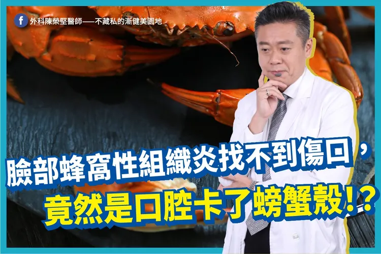 蜂窩性組織炎卻找不到傷口，腫了半邊臉，原來是牙齒卡了螃蟹殼。翻攝臉書「外科陳榮堅醫師——不藏私的漸健美園地」