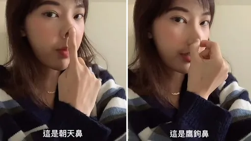 朝天鼻鷹鉤鼻變成我北鼻　喂！拜託不要好嗎