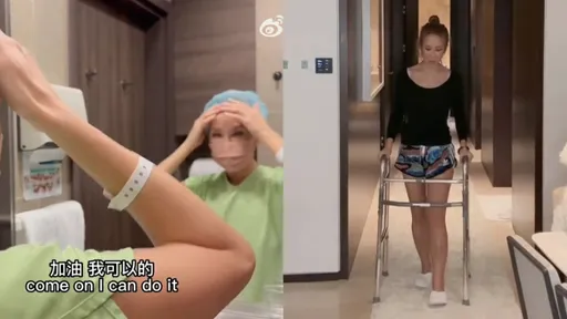 李玟隱藏左腿缺陷　僅靠右腳跳舞「只要大家開心，再痛也值得」