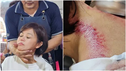 游淑慧遭架脖子!「兩道血痕」慘照曝光 網友驚呆