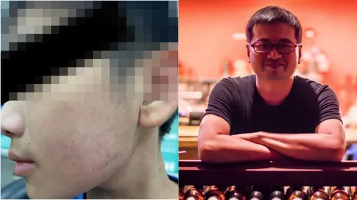 醫師打小孩100巴掌　工作慘況曝光！禾馨回應：錯就是錯了