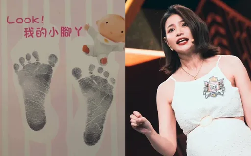 蘿莉塔昨剖腹產2600克女娃 臉型像媽五官像爸