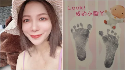 蘿莉塔陷產後地獄！「傷口痛得半死」冒冷汗頭暈　如廁崩潰「要花20分鐘」