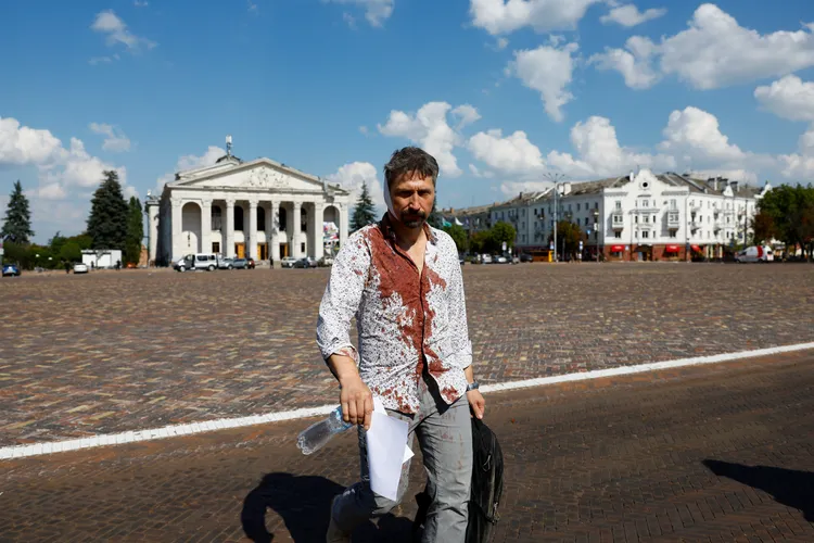 切爾尼戈夫一民眾衣服上都是血漬。路透社