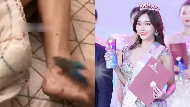 中國網路瘋傳雅典娜liya被凌虐的慘況。翻攝自雅典娜liya抖音、網路