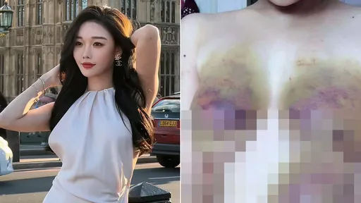 百萬網紅正妹被綁架「網瘋傳凌虐慘照」 遊菲出事!營救商會說話了