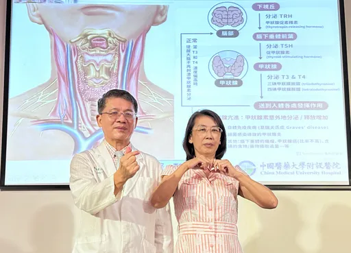 56歲男甲狀腺亢進1.5月暴瘦14公斤 中西醫合併用藥成功逆轉