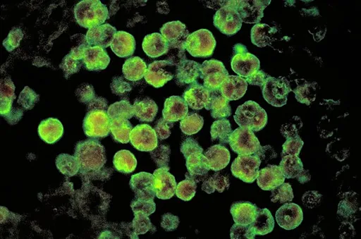 驚!隔12年再現「食腦變形蟲」 北部30歲女玩水後第7天喪命