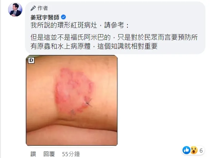 姜冠宇呼籲「環形紅斑」就要警覺。取自姜冠宇臉書