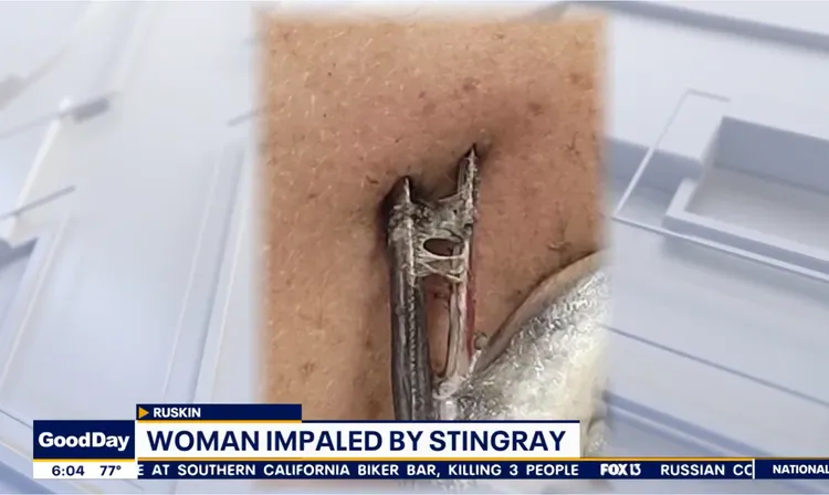 魟魚尾部刺有倒鉤。福斯新聞網