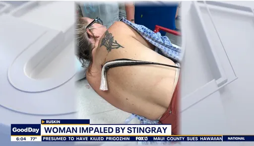 有毒!海灘戲水「魟魚整隻掛她背上」 醫護切斷尾部急送醫