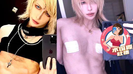 木瓜霞|斷捨離最高境界 他為當最強吉他手竟切除乳頭