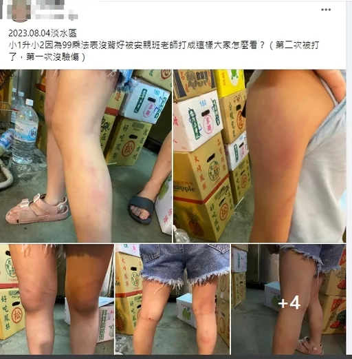 女童背不出九九乘法表　安親班師打到滿身傷！四肢多處瘀青