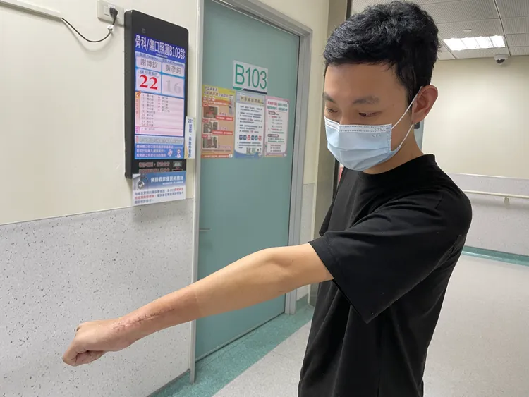 陳先生左手腕功能逐漸復原。院方提供