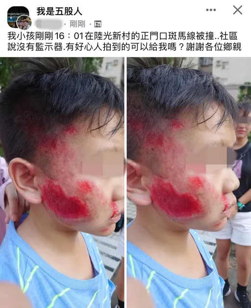 新北10歲童走斑馬線遭撞「滿臉血痕」 爸爸心疼求援