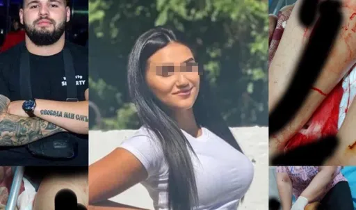 打斷鼻子全身割400道傷　法官卻說「輕傷」！正妹遭前男友施暴網怒了