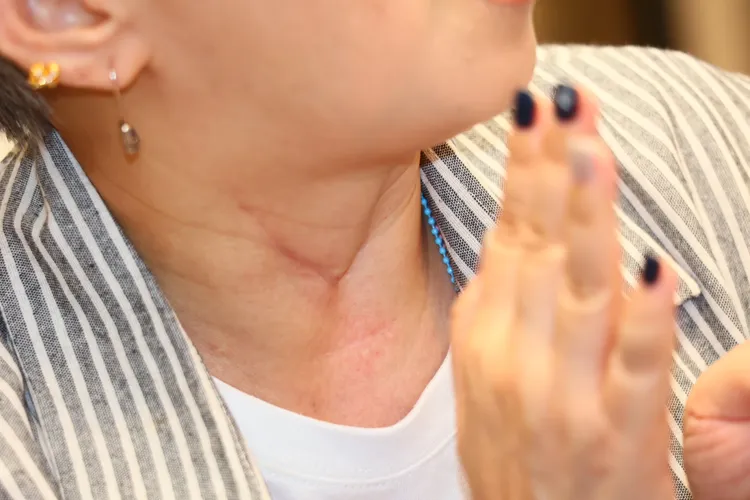 李明依脖子上有開刀留下的痕跡。彭欣偉攝