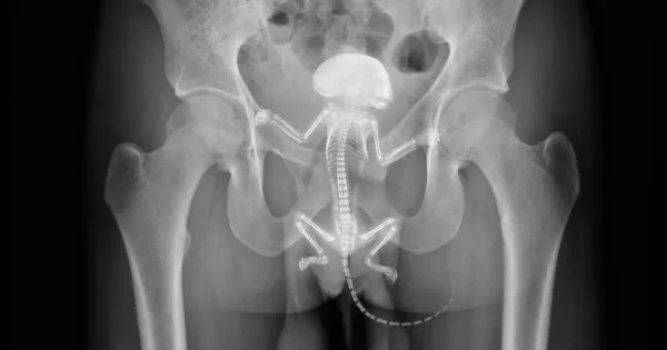 X光片顯示，松鼠整隻卡進法蘭克肛門內，只剩下尾巴露在外。翻攝自網路teakdoor