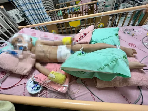 苗栗早療機構5歲自閉童頭部重創 送醫9天仍昏迷!家屬淚求真相