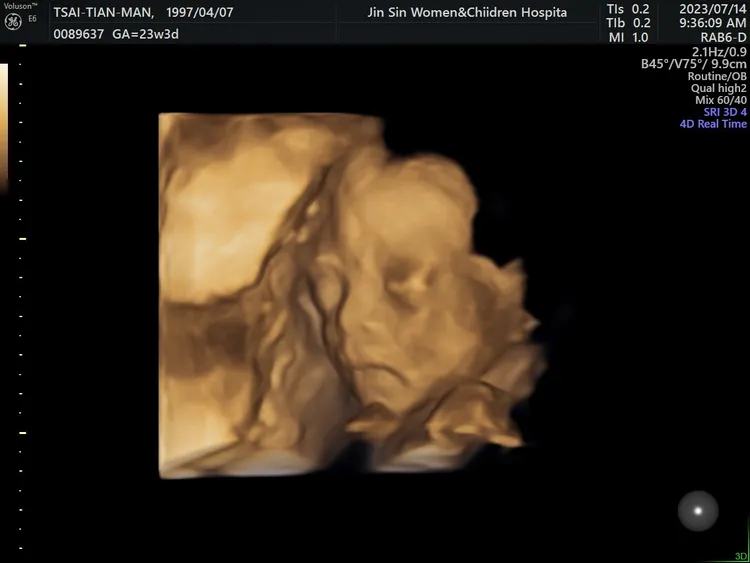 高層次超音波7月中清楚拍下蔡女肚內孩子的輪廓。蔡女提供