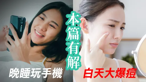 必看!爱晚睡助长痘痘齐生 救脸大作战开跑