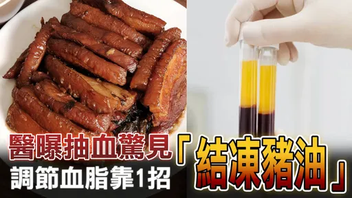 醫曝抽血驚見「結凍豬油」調節血脂靠1招