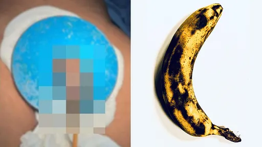 健身教練操雞「陰莖舉重3公斤」 卡2小時變烏骨雞痛爆求援