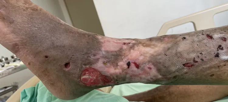 治療後。院方提供