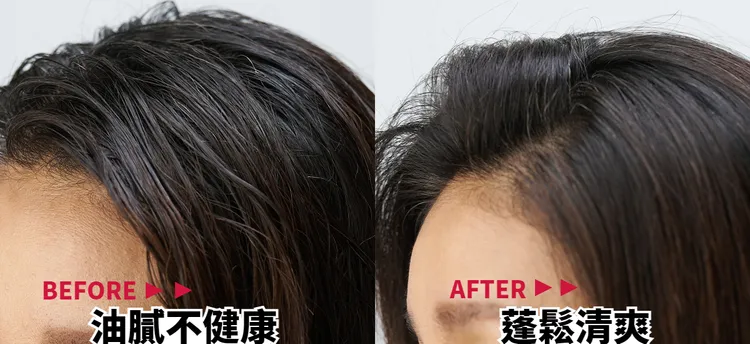 ▲實際使用後，原本油膩扁塌的頭頂，變得蓬鬆清爽。 