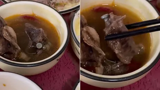 人肉湯?他們用餐吃到「肉裡長釘」 網友炸鍋:那是骨科手術用的