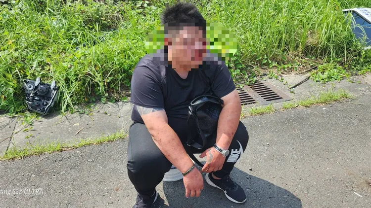 30歲駕駛臉上有擦挫傷。讀者提供