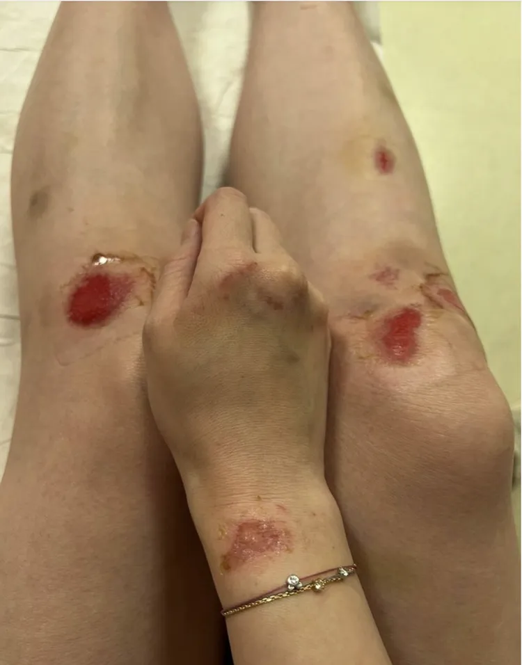 高嘉瑜傷勢驚人。高嘉瑜辦公室提供