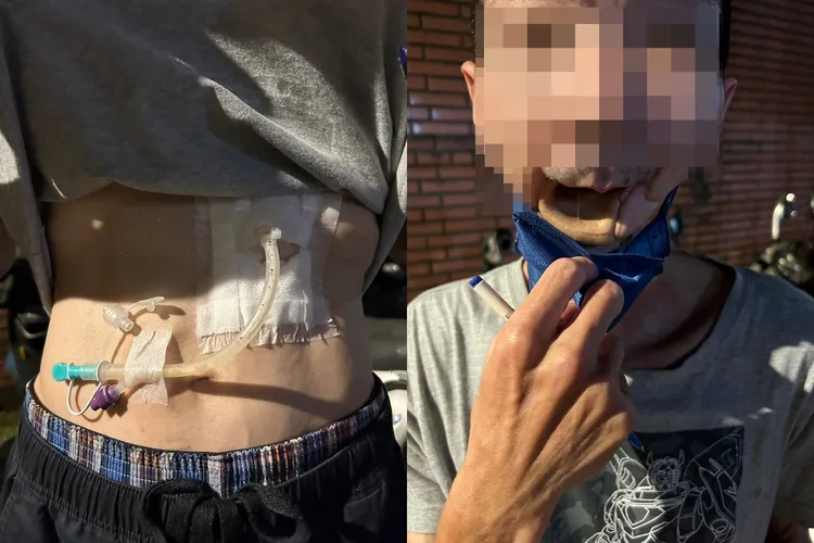 聲障父因罹口腔癌，只能靠灌食維生。設計畫面