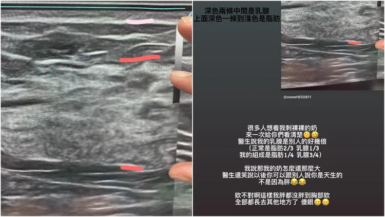 田甜說，給粉絲看「刺(赤)裸裸的奶」。翻攝田甜自IG