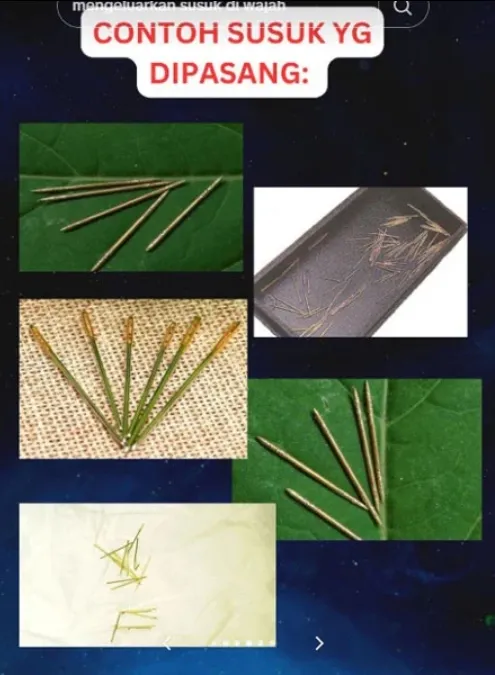 魅力針多是金屬製。取自中國報