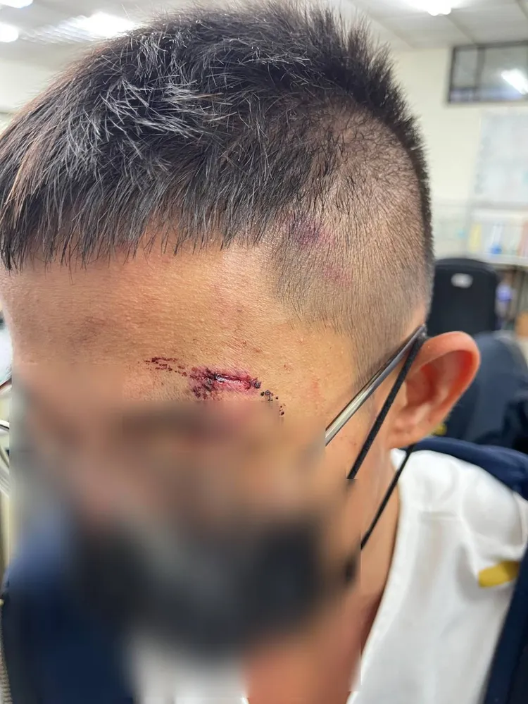 被害人遭毆打凌虐，全身傷痕累累。民眾提供