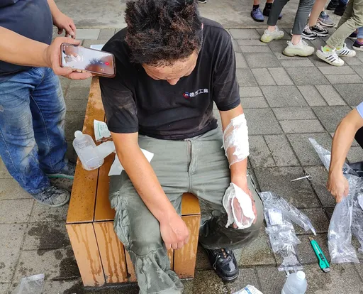 疑天然气泄漏气爆　湖口医药生技公司1员工9%灼伤