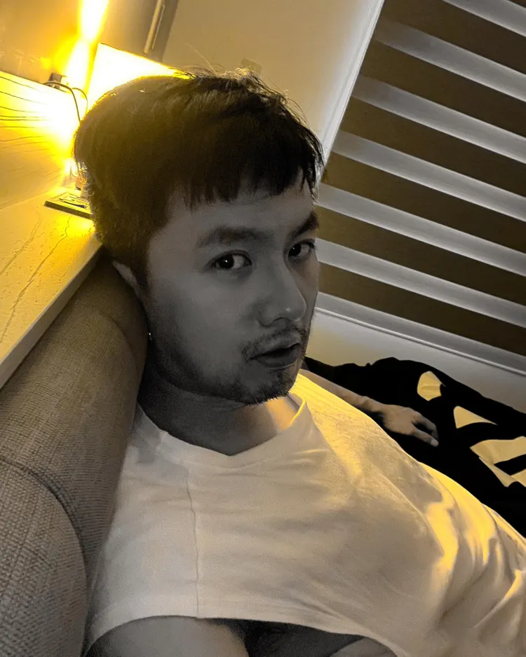 張雁名手術後一周臉部消腫，不過確定傷到神經。翻攝自張雁名臉書