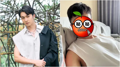 男星「開刀傷神經」腫臉照曝光!下唇下巴沒知覺 恐永遠不會好