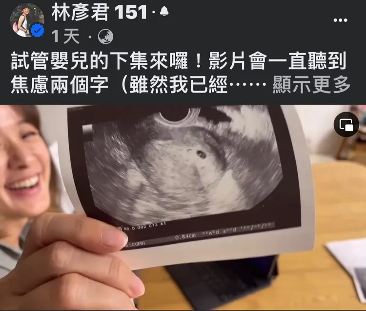 林彥君分享超音波照片。翻攝林彥君臉書