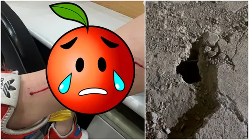 女童逛夜市踩空 小腿留3道血痕!網見畫面心驚:光是看就好痛