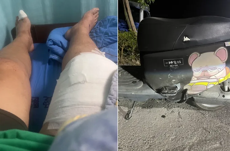 王男受傷住院，電動機車則是送修，保管費也日日累計。王先生提供