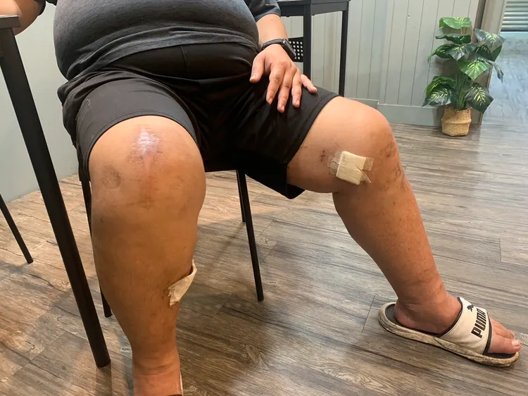 王男現在仍行動不便。江孟謙攝