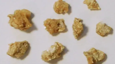 蝦毀!18歲男大生得腎結石 原來是他天天喝這種飲料