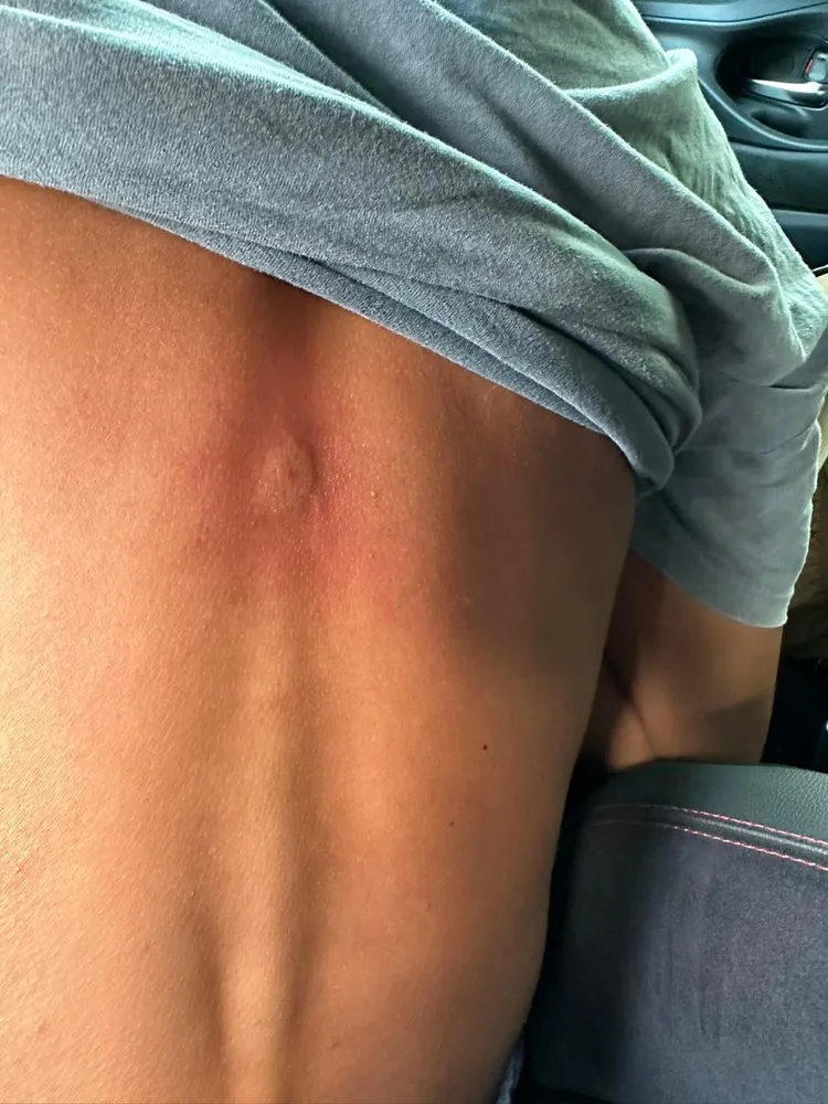 吳慷仁2022年被虎頭蜂「親」一下。翻攝吳慷仁臉書