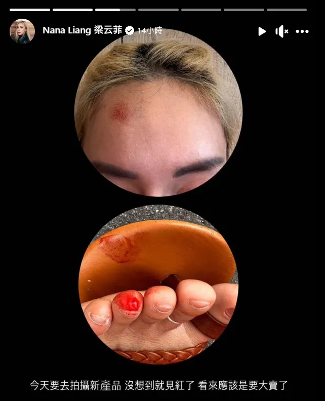 「國光女神」梁云菲（Nana）昨上工遇車禍。翻攝梁云菲臉書
