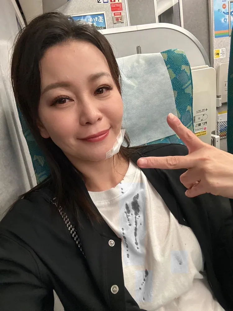 謝宜君出意外，白上衣有大片血跡。照片變色處理。取自謝宜君臉書