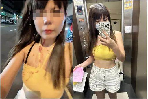 网美自称「年轻漂亮」遭酒吧女忌妒砸头缝3针 真相竟是这么回事