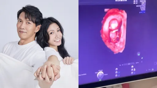 恭喜！李千娜懷孕了　喜曬超音波照證實懷三寶